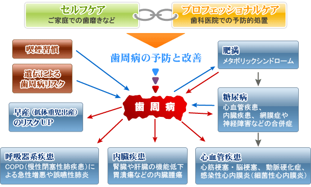 歯周病の予防と改善