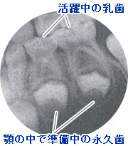 子どもの口腔環境