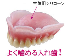 シリコーン義歯