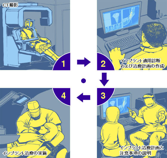 ＣＴ撮影からインプラント治療まで