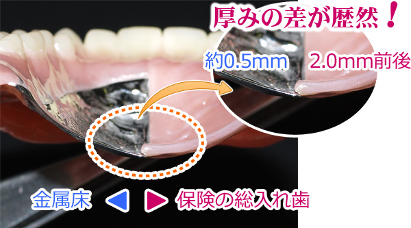 入れ歯・義歯 / 入間市・武蔵藤沢駅の歯科医院「ファースト歯科